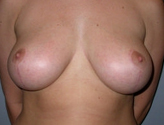 Patient # 19786 After Photo # 2